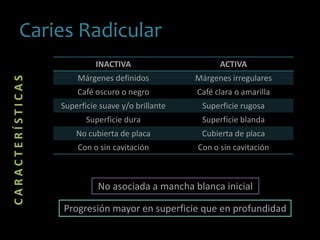 Caries Radicular
CARACTERÍSTICAS
INACTIVA ACTIVA
Márgenes definidos Márgenes irregulares
Café oscuro o negro Café clara o amarilla
Superficie suave y/o brillante Superficie rugosa
Superficie dura Superficie blanda
No cubierta de placa Cubierta de placa
Con o sin cavitación Con o sin cavitación
No asociada a mancha blanca inicial
Progresión mayor en superficie que en profundidad
 