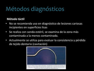 Método táctil
• No se recomienda uso en diagnóstico de lesiones cariosas
incipientes en superficies lisas
• Se realiza con sonda estéril, se examina de la zona más
contaminada a la menos contaminada.
• Actualmente se utiliza para evaluar la consistencia y pérdida
de tejido dentario (cavitación)
Métodos diagnósticos
 