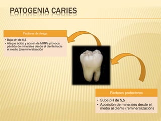 PATOGENIA CARIES
Factores protectores
• Sube pH de 5,5
• Aposición de minerales desde el
medio al diente (remineralización)
Factores de riesgo
• Baja pH de 5,5
• Ataque ácido y acción de MMPs provoca
pérdida de minerales desde el diente hacia
el medio (desmineralización
 