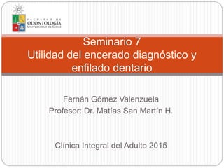 Fernán Gómez Valenzuela
Profesor: Dr. Matías San Martín H.
Clínica Integral del Adulto 2015
Seminario 7
Utilidad del encerado diagnóstico y
enfilado dentario
 