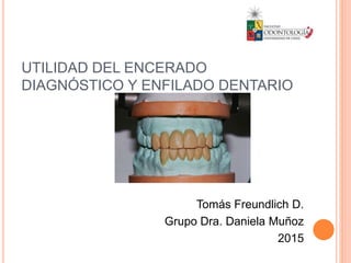 UTILIDAD DEL ENCERADO
DIAGNÓSTICO Y ENFILADO DENTARIO
Tomás Freundlich D.
Grupo Dra. Daniela Muñoz
2015
 