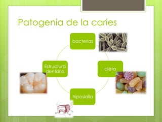 Patogenia de la caries
bacterias
dieta
hiposialia
Estructura
dentaria
 