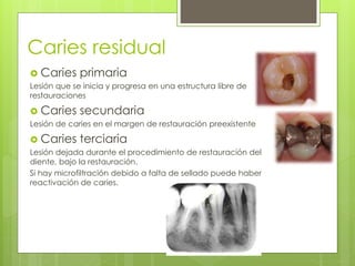 Caries residual
 Caries primaria
Lesión que se inicia y progresa en una estructura libre de
restauraciones
 Caries secundaria
Lesión de caries en el margen de restauración preexistente
 Caries terciaria
Lesión dejada durante el procedimiento de restauración del
diente, bajo la restauración.
Si hay microfiltración debido a falta de sellado puede haber
reactivación de caries.
 