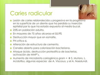 Caries radicular
 Lesión de caries reblandecida y progresiva en la progresiva
en la superficie de un diente que ha perdido su inserción
epitelial por lo que ha estado expuesta al medio bucal.
 25% en población adulta.
 En mayores de 75 años alcanza el 55,9%
 Destrucción mayor que en esmalte.
 PH crítico 6.
 Alteración de estructura de cemento.
 Canales abierto para colonización bacteriana.
 Ataque ácido, destrucción proteolítica de bacterias,
activación de MMP’s.
 Aumento de microbiota cariogénica gram +  S. Mutans, L.
Acidofilus, algunas especies de A. Viscosus, y el A. Naeslundi.
 