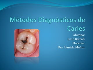 Alumno:
Livio Barnafi
Docente:
Dra. Daniela Muñoz
 