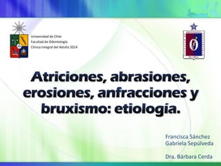 Francisca Sánchez
Gabriela Sepúlveda
Dra. Bárbara Cerda
Universidad de Chile
Facultad de Odontología
Clínica Integral del Adulto 2014
 