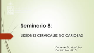 Seminario 8:
LESIONES CERVICALES NO CARIOSAS
Docente: Dr. Montalva
Daniela Mansilla D.
 