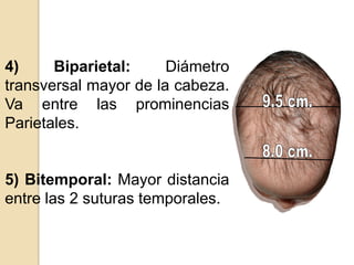 4) Biparietal: Diámetro
transversal mayor de la cabeza.
Va entre las prominencias
Parietales.
5) Bitemporal: Mayor distancia
entre las 2 suturas temporales.
 