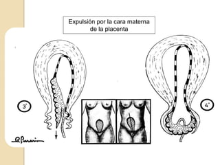 Expulsión por la cara materna
de la placenta
 