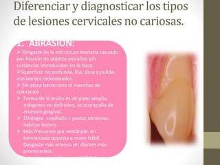 Diferenciar y diagnosticar los tipos
de lesiones cervicales no cariosas.
1. ABRASIÓN:
 Desgaste de la estructura dentaria causado
por fricción de objetos extraños y/o
sustancias introducidas en la boca.
Superficie no profunda, lisa, dura y pulida,
con bordes redondeados.
 Sin placa bacteriana ni manchas de
coloración.
 Forma de la lesión es de plato amplio,
márgenes no definidos, se acompaña de
recesión gingival.
 Etiología: cepillado + pastas abrasivas,
hábitos lesivos.
 Más frecuente por vestibular, en
hemiarcada opuesta a mano hábil.
Desgaste más intenso en dientes más
prominentes.
Se asocia a recesión y sensibilidad.
 