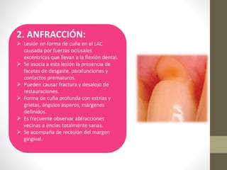 2. ANFRACCIÓN:
 Lesión en forma de cuña en el LAC
causada por fuerzas oclusales
excéntricas que llevan a la flexión dental.
 Se asocia a esta lesión la presencia de
facetas de desgaste, parafunciones y
contactos prematuros.
 Pueden causar fractura y desalojo de
restauraciones.
 Forma de cuña profunda con estrías y
grietas, ángulos ásperos, márgenes
definidos.
 Es frecuente observar abfracciones
vecinas a encías totalmente sanas.
 Se acompaña de recesión del margen
gingival.
 