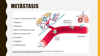 METÁSTASIS
 