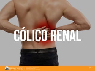01/08/2018
11
algia
Cólico renal
 