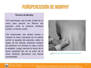 01/08/2018
15
Puñopercusión de Murphy
Motta-Ramírez, GA., Uscanga-Carmona, MC. Puntos clínicos de Murphy, Mc Burbey y
Giordano: Valor actual y su correlación con la ultrasonografía. Anales de Radiología. México
Tomado de: https://quizlet.com/cl/516125592/examen-fisico-del-abdomen-flash-
cards/
Técnica de Murphy
1-El examinador usa el lado cubital de la
mano para percutir los flancos del
paciente, entre la columna vertebral
lumbar y el borde costal.
2-El examinador use ambas manos y
coloque la mano izquierda con la palma
contra la espalda del paciente, sobre la
región de los riñones, teniendo cuidado
de presionar con firmeza la mano contra
la espalda. Luego, percute el dorso de la
mano izquierda fija con el puño de la
mano derecha, ejerciendo una fuerza
considerable.
 