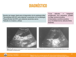 01/08/2018
27
diagnóstico
Motta-Ramírez, GA., Uscanga-Carmona, MC. Puntos clínicos de Murphy, Mc Burbey y
Giordano: Valor actual y su correlación con la ultrasonografía. Anales de Radiología. México
Estudio de imagen ideal para el diagnóstico de la patología biliar
*Sensibilidad del 83% para detectar a pacientes con la patología
*Especificidad del 95% para detectar pacientes sanos
*Estudio no invasivo y eficaz
1-Los cálculos -> Imágenes
ecogénicas; muy pequeños, pueden
no dejar sombra acústica.
2-Asociados a sombra acústica
3-La movilidad de los cálculos libres
flotantes.
 