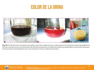 01/08/2018
32
color de la orina
Argente HA. Semiologia medica fisiopatologia, semiotecnia y propedéutica. Enseñanza basada en el paciente.
2a ed. Editorial Médica Panamericana; 2013.
 