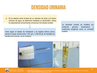 01/08/2018
34
densidad urinaria
❏ Es la relación entre el peso de un volumen de orina y el mismo
volumen de agua, se determina mediante un densímetro. Indica
la capacidad de concentración urinaria por los túbulos renales.
Varía según el estado de hidratación y la ingesta hídrica previa,
siendo el rango normal entre 1,001 g/l y 1,030-35 g/l. El resultado se
escribe como se lee, no en números.
La densidad urinaria se modifica por
proteínas, glucosa, temperatura y
sustancias exógenas como el contraste
yodado.
Argente HA. Semiologia medica fisiopatologia, semiotecnia y propedéutica. Enseñanza basada en el paciente.
2a ed. Editorial Médica Panamericana; 2013.
 