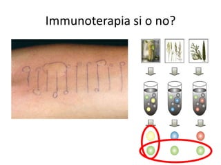 Immunoterapia si o no?
 