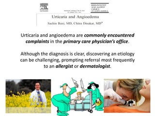 Urticaria and angioedema are commonly encountered
  complaints in the primary care physician’s office.

Although the diagnosis is clear, discovering an etiology
can be challenging, prompting referral most frequently
           to an allergist or dermatologist.
 