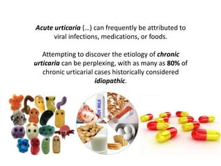 Acute urticaria (…) can frequently be attributed to
      viral infections, medications, or foods.

   Attempting to discover the etiology of chronic
urticaria can be perplexing, with as many as 80% of
   chronic urticarial cases historically considered
                      idiopathic.
 