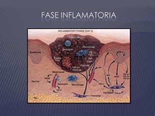 Fase inflamatoria