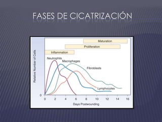 Fases de cicatrización