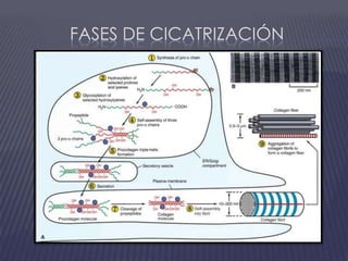 Fases de cicatrización