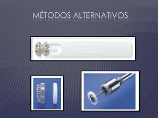 Métodos Alternativos