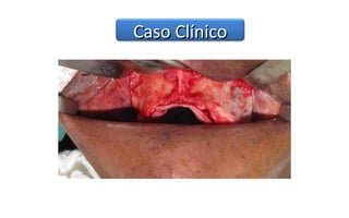 Caso Clínico
 