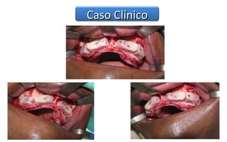 Caso Clínico
 