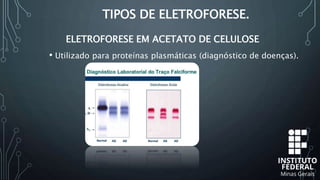 TIPOS DE ELETROFORESE.
• Utilizado para proteínas plasmáticas (diagnóstico de doenças).
ELETROFORESE EM ACETATO DE CELULOSE
 