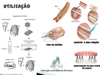Substituição de uma parte
do corpo
Assistir a uma função
Liberação controlada de fármacos
Fios de sutura
 