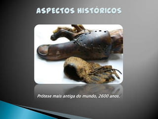 Prótese mais antiga do mundo, 2600 anos.
 