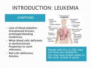 SYMPTOMS
People with CLL or CML may
not have any symptoms.
CLL may have lymph nodes in
the neck, armpit or groin.
 Lack of blood platelets:
Unexplained bruises,
prolonged bleeding
tendencies.
 White blood cells deficients
or dysfunctionals:
Propensity to catch
infections.
 Red cells deficiency:
Anemia.
 