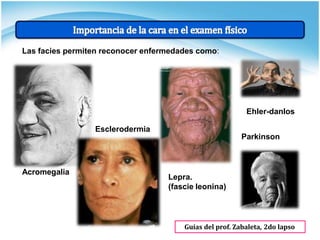 Las facies permiten reconocer enfermedades como:
Acromegalia
Esclerodermia
Lepra.
(fascie leonina)
Parkinson
Guías del prof. Zabaleta, 2do lapso
Ehler-danlos
 