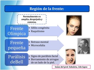 Región de la frente:
Normalmente es
amplia, despejada y
convexa.
• Sífilis congénita
• Raquitismo
• Retraso mental
• Microcefalia
• Signo de parálisis facial
• Borramiento de arrugas
de un lado de la piel.
Frente
Olímpica
Frente
pequeña
Parálisis
deBell
Guías del prof. Zabaleta, 2do lapso
 