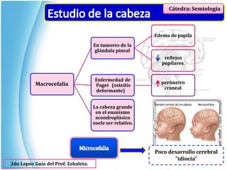 Cátedra: Semiología
Macrocefalia
Edema de papila
En tumores de la
glándula pineal
reflejos
pupilares.
Enfermedad de
Paget (osteítis
deformante)
perímetro
craneal
La cabeza grande
en el enanismo
acondroplásico
suele ser relativo.
Poco desarrollo cerebral
“idiocia”
2do Lapso Guía del Prof. Zabaleta.
 