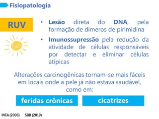 INCA (2006)
Fisiopatologia
RUV • Lesão direta do DNA, pela
formação de dímeros de pirimidina
• Imunossupressão pela redução da
atividade de células responsáveis
por detectar e eliminar células
atípicas
Alterações carcinogênicas tornam-se mais fáceis
em locais onde a pele já não estava saudável,
como em:
SBD (2019)
cicatrizes
feridas crônicas
 
