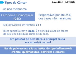 Tipos de Câncer
Carcinoma Espinocelular
(CEC)
Os não melanoma
Responsável por até 25%
dos casos não melanoma
Mais prevalente em homens: 3 : 1
Risco aumenta com a idade. É a principal causa de câncer
de pele em indivíduos acima de 85 anos.
Em pessoas de pele clara, a principal causa
é a exposição ao sol
Azulay (2004) | Hoff (2013)
Nas de pele escura, são as lesões do tipo inflamatória
crônica, queimaduras, cicatrizes e escaras
 