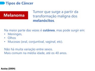 Azulay (2004)
Melanoma
Tipos de Câncer
Tumor que surge a partir da
transformação maligna dos
melanócitos.
Na maior parte das vezes é cutâneo, mas pode surgir em:
• Meninges,
• Olhos
• Mucosas (oral, conjuntival, vaginal, etc).
Não há muita variação entre sexos.
Mais comum na média idade, até os 40 anos.
 