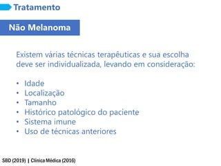 SBD (2019) | Clínica Médica (2016)
Tratamento
Existem várias técnicas terapêuticas e sua escolha
deve ser individualizada, levando em consideração:
• Idade
• Localização
• Tamanho
• Histórico patológico do paciente
• Sistema imune
• Uso de técnicas anteriores
Não Melanoma
 