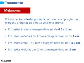 Azulay (2004)
Tratamento
O tratamento da lesão primária consiste na ampliação das
margens cirúrgicas da biópsia excisional prévia.
• Em lesões in situ, a margem deve ser de 0,5 a 1 cm,
• Em lesões menores de 1 mm a margem deve ser de 1 cm,
• Em lesões entre 1 e 2 mm a margem deve ser de 1 a 2 cm,
• Em lesões maiores que 2 mm a margem deve ser 2 cm
Melanoma
 