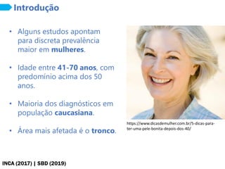 INCA (2017) | SBD (2019)
Introdução
• Alguns estudos apontam
para discreta prevalência
maior em mulheres.
• Idade entre 41-70 anos, com
predomínio acima dos 50
anos.
• Maioria dos diagnósticos em
população caucasiana.
• Área mais afetada é o tronco.
https://www.dicasdemulher.com.br/5-dicas-para-
ter-uma-pele-bonita-depois-dos-40/
 