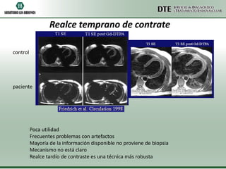 Realce temprano de contrate

control




paciente




          Poca utilidad
          Frecuentes problemas con artefactos
          Mayoría de la información disponible no proviene de biopsia
          Mecanismo no está claro
          Realce tardío de contraste es una técnica más robusta
 