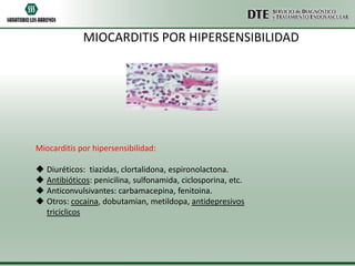 MIOCARDITIS POR HIPERSENSIBILIDAD




Miocarditis por hipersensibilidad:

 Diuréticos: tiazidas, clortalidona, espironolactona.
 Antibióticos: penicilina, sulfonamida, ciclosporina, etc.
 Anticonvulsivantes: carbamacepina, fenitoina.
 Otros: cocaina, dobutamian, metildopa, antidepresivos
  triciclicos
 