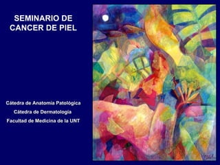 SEMINARIO DE CANCER DE PIEL Cátedra de Anatomía Patológica Cátedra de Dermatología  Facultad de Medicina de la UNT 