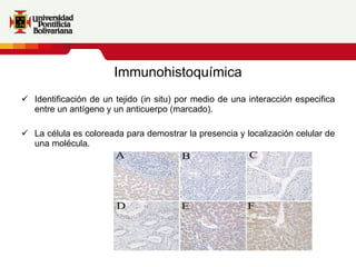 Immunohistoquímica Identificación de un tejido (in situ) por medio de una interacción especifica entre un antígeno y un anticuerpo (marcado). La célula es coloreada para demostrar la presencia y localización celular de una molécula. 