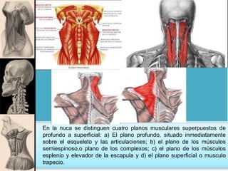En la nuca se distinguen cuatro planos musculares superpuestos de
profundo a superficial: a) El plano profundo, situado inmediatamente
sobre el esqueleto y las articulaciones; b) el plano de los músculos
semiespinoso,o plano de los complexos; c) el plano de los músculos
esplenio y elevador de la escapula y d) el plano superficial o musculo
trapecio.
 