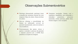 Observações Submentovértice
 Patologia demonstrada: patologia óssea
avançada das estruturas internas do osso
temporal. Base do crânio, fratura da base
do crânio.
 Deve-se eliminar a possibilidade de
fratura ou subluxação cervical no
paciente traumatizado, antes de realizar o
essa incidência.
 Posicionamento das partes: elevar o
queixo e estender o pescoço do paciente
o máximo possível até a LIOM ficar
paralela ao receptor de imagem.
 Estruturas mostradas: forame oval e
espinhoso, mandíbula, seio esfenoidal, e
etmoidais posteriores, processos
mastoides, cristas petrosas, palato duro,
forame magno e osso occipital.
 