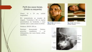 Perfil dos ossos faciais.
(Direito ou esquerdo)
Chassi: 18 x 24 cm, sentido
longitudinal.
RC: perpendicular ao receptor de
imagem. Centralizar o RC no zigoma
(proeminência da bochecha), a meio
caminho entre o canto externo do MAE.
Distância: DFOFi 100 cm.
Patologia demonstrada: fraturas,
processos neoplásicos e ou
inflamatórios, dos ossos faciais, orbita,
mandíbula.
 